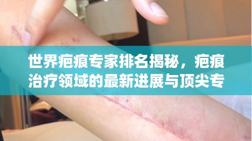 世界疤痕专家排名揭秘，疤痕治疗领域的最新进展与顶尖专家解读